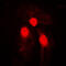 SMAD Family Member 3 antibody, GTX32214, GeneTex, Immunofluorescence image 
