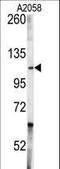ABL Proto-Oncogene 1, Non-Receptor Tyrosine Kinase antibody, LS-C99162, Lifespan Biosciences, Western Blot image 