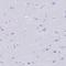 Cytidine Deaminase antibody, NBP2-39019, Novus Biologicals, Immunohistochemistry paraffin image 