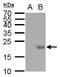 Ubiquitin Conjugating Enzyme E2 B antibody, TA308525, Origene, Western Blot image 