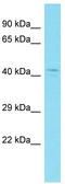 Coiled-Coil Domain Containing 74B antibody, TA333310, Origene, Western Blot image 