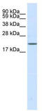 Sodium Voltage-Gated Channel Beta Subunit 3 antibody, TA331466, Origene, Western Blot image 