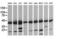 Mitogen-Activated Protein Kinase Kinase 1 antibody, LS-C174639, Lifespan Biosciences, Western Blot image 