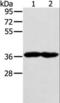 G Protein Subunit Alpha Transducin 3 antibody, LS-C406431, Lifespan Biosciences, Western Blot image 