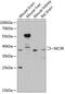 Melanocortin 3 Receptor antibody, GTX64785, GeneTex, Western Blot image 