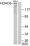 Histone Deacetylase 6 antibody, LS-B7604, Lifespan Biosciences, Western Blot image 
