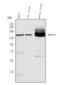 ATP Binding Cassette Subfamily B Member 11 antibody, PB9414, Boster Biological Technology, Western Blot image 