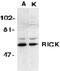 Receptor Interacting Serine/Threonine Kinase 2 antibody, GTX28428, GeneTex, Western Blot image 