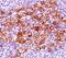 TNF Receptor Superfamily Member 8 antibody, 33-094, ProSci, Immunohistochemistry paraffin image 