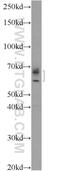 Interferon Induced Protein With Tetratricopeptide Repeats 1B antibody, 21483-1-AP, Proteintech Group, Western Blot image 