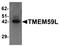 Transmembrane Protein 59 Like antibody, orb75643, Biorbyt, Western Blot image 