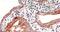 Inhibitor Of Nuclear Factor Kappa B Kinase Subunit Beta antibody, GTX12139, GeneTex, Immunohistochemistry paraffin image 