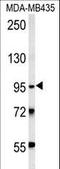 Thyrotropin Releasing Hormone Degrading Enzyme antibody, LS-C160172, Lifespan Biosciences, Western Blot image 