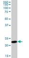 Signal Sequence Receptor Subunit 2 antibody, H00006746-B01P, Novus Biologicals, Western Blot image 