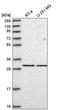 Eukaryotic Translation Initiation Factor 2B Subunit Alpha antibody, PA5-65564, Invitrogen Antibodies, Western Blot image 