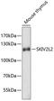 Mtr4 Exosome RNA Helicase antibody, 19-413, ProSci, Western Blot image 