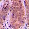 Potassium Voltage-Gated Channel Subfamily A Member 1 antibody, orb214147, Biorbyt, Immunohistochemistry paraffin image 