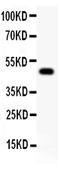 LDL Receptor Related Protein 1 antibody, PB9143, Boster Biological Technology, Western Blot image 