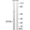 Eukaryotic Translation Initiation Factor 3 Subunit K antibody, A07789, Boster Biological Technology, Western Blot image 