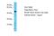 Protein Kinase C Theta antibody, PA5-70232, Invitrogen Antibodies, Western Blot image 