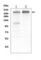 TSC Complex Subunit 2 antibody, M00229-1, Boster Biological Technology, Western Blot image 