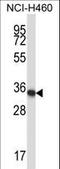 Homeobox A11 antibody, LS-C164403, Lifespan Biosciences, Western Blot image 