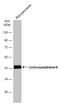 Carboxypeptidase B1 antibody, GTX114334, GeneTex, Western Blot image 