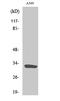 Solute Carrier Family 39 Member 9 antibody, A13097-1, Boster Biological Technology, Western Blot image 