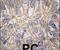 Cadherin 3 antibody, PA5-11587, Invitrogen Antibodies, Immunohistochemistry paraffin image 