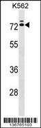 Interleukin 23 Receptor antibody, 58-876, ProSci, Western Blot image 