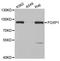 Forkhead Box P1 antibody, orb167199, Biorbyt, Western Blot image 
