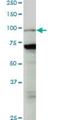 Lysine Acetyltransferase 2B antibody, H00008850-M04, Novus Biologicals, Western Blot image 