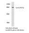 Ezrin antibody, LS-C177767, Lifespan Biosciences, Western Blot image 