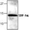 C-X-C Motif Chemokine Ligand 12 antibody, GTX59856, GeneTex, Western Blot image 