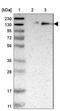 Ubiquitin Specific Peptidase 36 antibody, NBP1-83709, Novus Biologicals, Western Blot image 