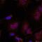 JunB Proto-Oncogene, AP-1 Transcription Factor Subunit antibody, PA5-37621, Invitrogen Antibodies, Immunofluorescence image 