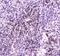 ME1 antibody, A01582-2, Boster Biological Technology, Immunohistochemistry paraffin image 