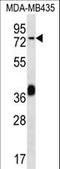 BAL antibody, LS-C168657, Lifespan Biosciences, Western Blot image 