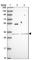 SH2B Adaptor Protein 2 antibody, HPA051131, Atlas Antibodies, Western Blot image 