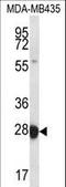 RAB27B, Member RAS Oncogene Family antibody, LS-C162375, Lifespan Biosciences, Western Blot image 