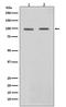 Signal Transducer And Activator Of Transcription 6 antibody, M00523-1, Boster Biological Technology, Western Blot image 