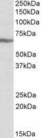 Insulin Like Growth Factor 2 MRNA Binding Protein 1 antibody, LS-B8333, Lifespan Biosciences, Western Blot image 