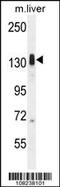 Lemur Tyrosine Kinase 3 antibody, 55-905, ProSci, Western Blot image 