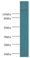 SWI/SNF Related, Matrix Associated, Actin Dependent Regulator Of Chromatin Subfamily C Member 2 antibody, A68311-100, Epigentek, Western Blot image 