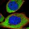 Calcium/Calmodulin Dependent Protein Kinase Kinase 2 antibody, HPA017389, Atlas Antibodies, Immunofluorescence image 
