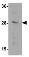 Transmembrane Protein 192 antibody, GTX32008, GeneTex, Western Blot image 