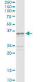 Sarcoglycan Gamma antibody, LS-C198182, Lifespan Biosciences, Immunoprecipitation image 