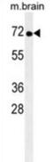 Non-receptor tyrosine-protein kinase TNK1 antibody, abx025220, Abbexa, Western Blot image 