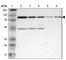 Activating Signal Cointegrator 1 Complex Subunit 2 antibody, HPA001439, Atlas Antibodies, Western Blot image 