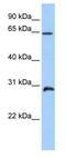 Homeobox A5 antibody, ab82645, Abcam, Western Blot image 